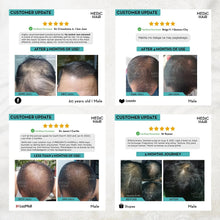 Load image into Gallery viewer, Medic Hair - The #1 Hair Loss Solution in the Philippines