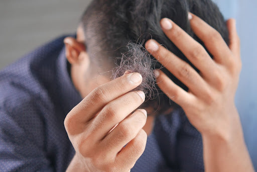 DHT - Its Role in Male Baldness and How We Stop It